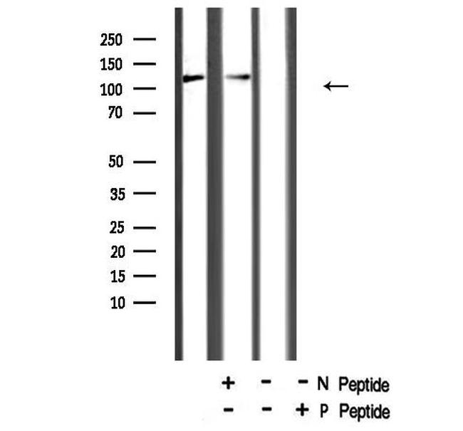 Phospho-NFkB p105 (Ser923) Antibody in Western Blot (WB)