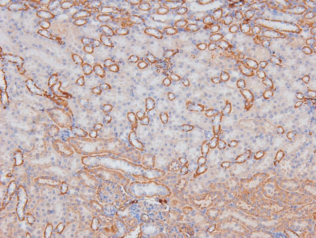 Phospho-RHOA (Ser188) Antibody in Immunohistochemistry (Paraffin) (IHC (P))