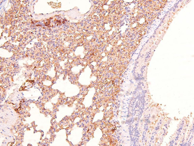 Phospho-RHOA (Ser188) Antibody in Immunohistochemistry (Paraffin) (IHC (P))