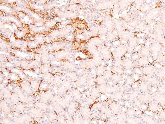 Phospho-RHOA (Ser188) Antibody in Immunohistochemistry (Paraffin) (IHC (P))