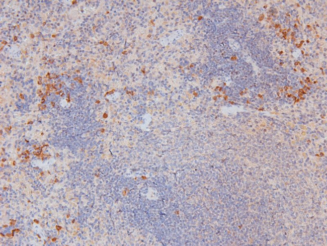 Phospho-RHOA (Ser188) Antibody in Immunohistochemistry (Paraffin) (IHC (P))