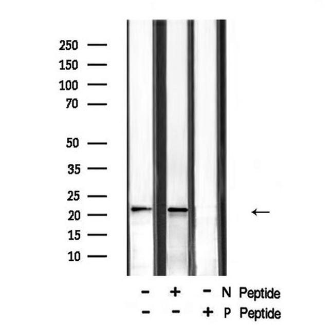 Phospho-RHOA (Ser188) Antibody in Western Blot (WB)