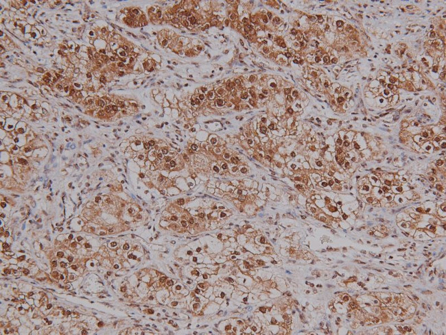 Phospho-VAV1 (Tyr160) Antibody in Immunohistochemistry (Paraffin) (IHC (P))