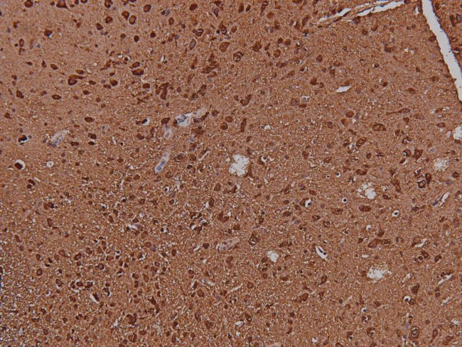 Phospho-VAV1 (Tyr160) Antibody in Immunohistochemistry (Paraffin) (IHC (P))