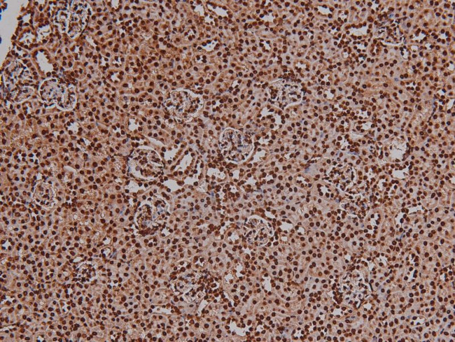 Phospho-VEGF Receptor 2 (Tyr996) Antibody in Immunohistochemistry (Paraffin) (IHC (P))