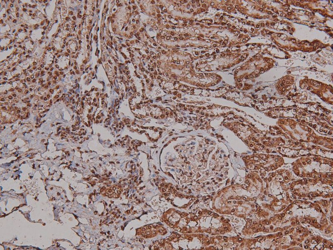 Phospho-VEGF Receptor 2 (Tyr996) Antibody in Immunohistochemistry (Paraffin) (IHC (P))