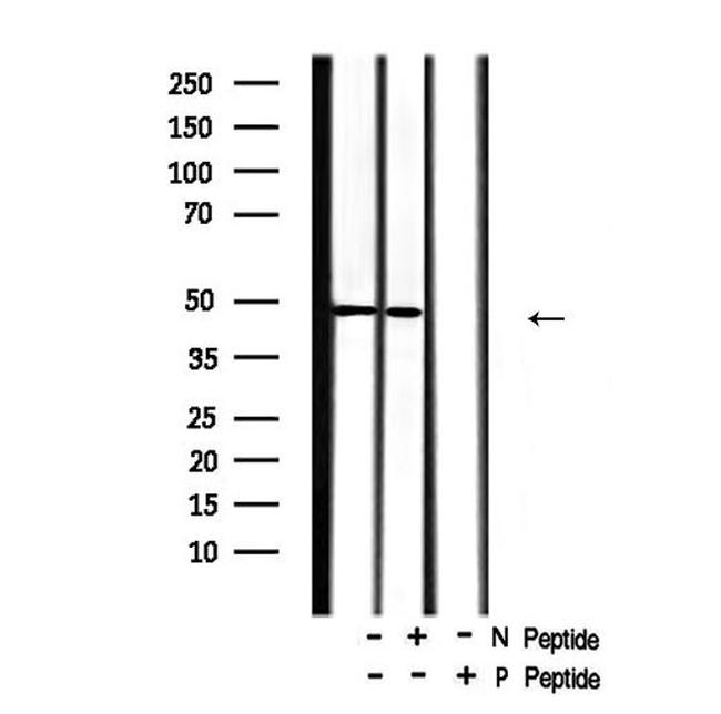 Phospho-Doublecortin (Ser297) Antibody in Western Blot (WB)