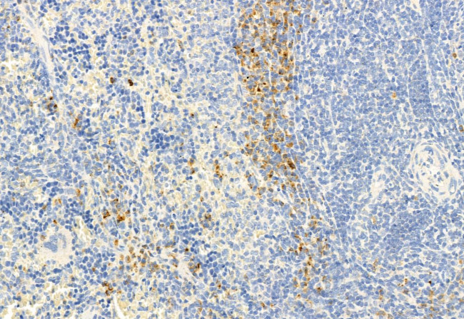 Phospho-HSL (Ser660) Antibody in Immunohistochemistry (Paraffin) (IHC (P))