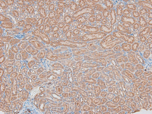 Phospho-HSL (Ser660) Antibody in Immunohistochemistry (Paraffin) (IHC (P))