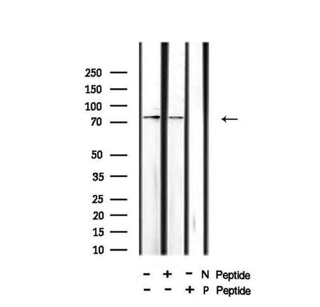 Phospho-HSL (Ser660) Antibody in Western Blot (WB)