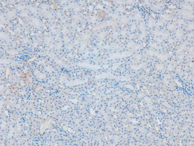 Phospho-PKC beta (Ser661) Antibody in Immunohistochemistry (Paraffin) (IHC (P))