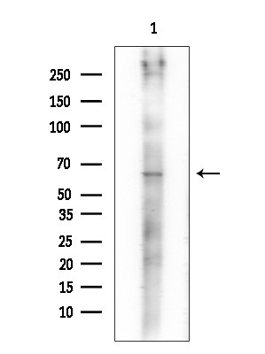 Phospho-Chk2 (Thr26, Ser28) Antibody in Western Blot (WB)