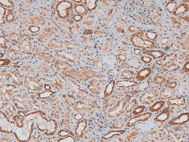 Phospho-Chk2 (Thr26, Ser28) Antibody in Immunohistochemistry (Paraffin) (IHC (P))