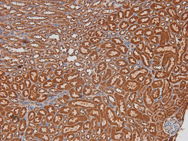 Phospho-Chk2 (Thr26, Ser28) Antibody in Immunohistochemistry (Paraffin) (IHC (P))