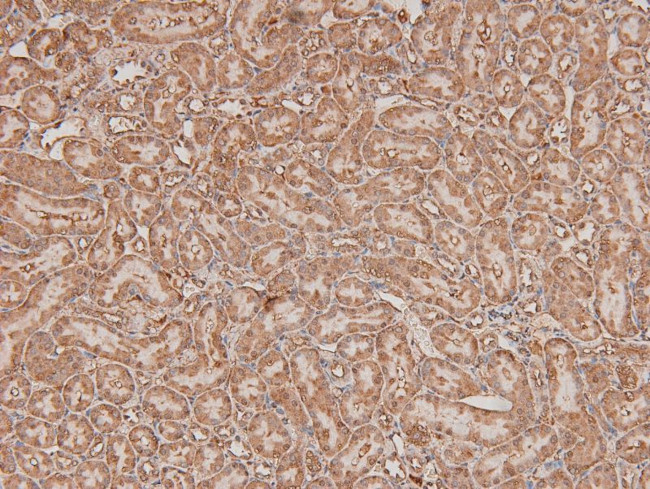 Phospho-Chk2 (Thr26, Ser28) Antibody in Immunohistochemistry (Paraffin) (IHC (P))