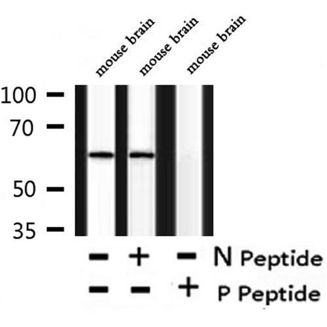 Phospho-Chk2 (Thr26, Ser28) Antibody in Western Blot (WB)