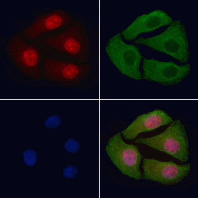 Phospho-MAP2K1/MAP2K2 (Ser218, Ser222, Ser226) Antibody in Immunocytochemistry (ICC/IF)