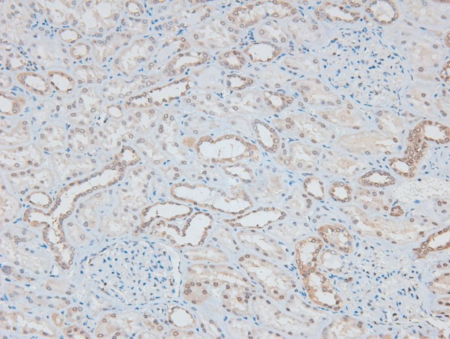 Phospho-MAP2K1/MAP2K2 (Ser218, Ser222, Ser226) Antibody in Immunohistochemistry (Paraffin) (IHC (P))