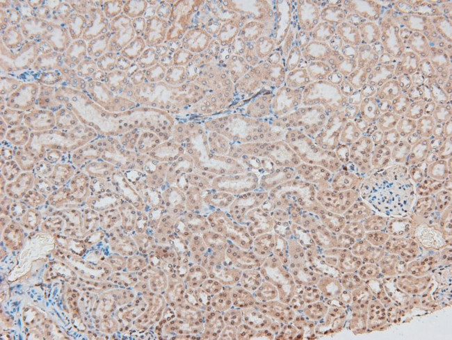 Phospho-MAP2K1/MAP2K2 (Ser218, Ser222, Ser226) Antibody in Immunohistochemistry (Paraffin) (IHC (P))