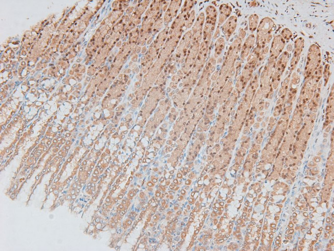 Phospho-MAP2K1/MAP2K2 (Ser218, Ser222, Ser226) Antibody in Immunohistochemistry (Paraffin) (IHC (P))