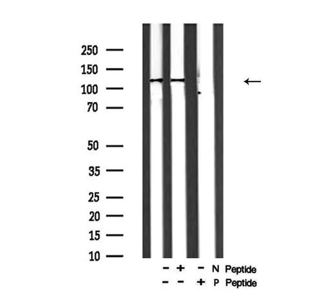 Phospho-p130 (Ser952) Antibody in Western Blot (WB)