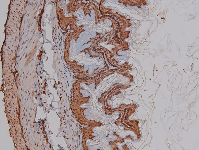 Phospho-CEACAM1 (Ser508) Antibody in Immunohistochemistry (Paraffin) (IHC (P))