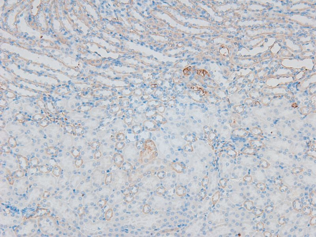 Phospho-CFTR (Ser737) Antibody in Immunohistochemistry (Paraffin) (IHC (P))