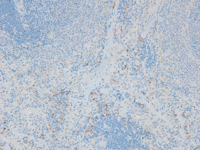 Phospho-CFTR (Ser737) Antibody in Immunohistochemistry (Paraffin) (IHC (P))