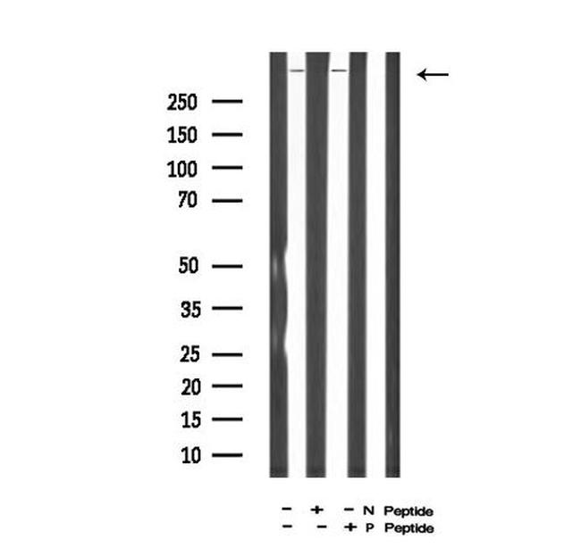 Phospho-DNA-PK (Ser2612) Antibody in Western Blot (WB)