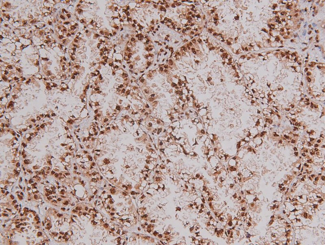 Phospho-RET (Tyr1096) Antibody in Immunohistochemistry (Paraffin) (IHC (P))