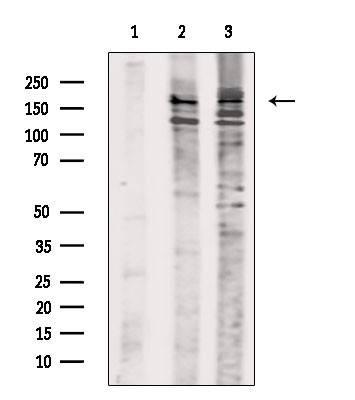 Phospho-RET (Tyr1096) Antibody in Western Blot (WB)