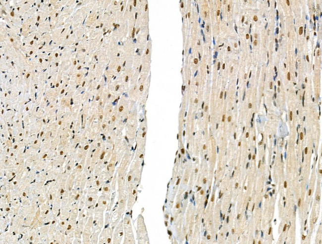 Phospho-SMAD2 (Ser255) Antibody in Immunohistochemistry (Paraffin) (IHC (P))