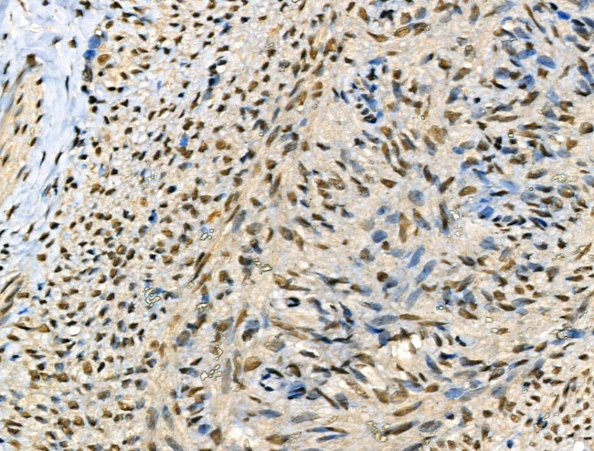 Phospho-SMAD2 (Ser255) Antibody in Immunohistochemistry (Paraffin) (IHC (P))