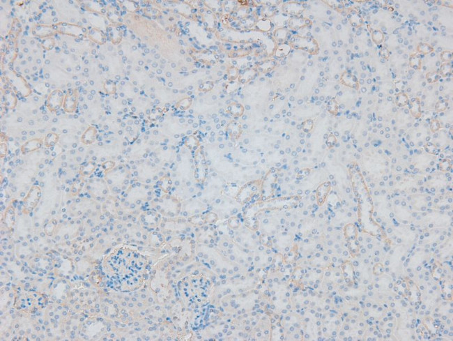 Phospho-ITGA4 (Ser1027) Antibody in Immunohistochemistry (Paraffin) (IHC (P))