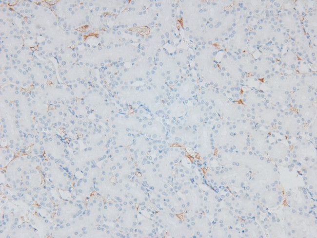 Phospho-ITGA4 (Ser1027) Antibody in Immunohistochemistry (Paraffin) (IHC (P))