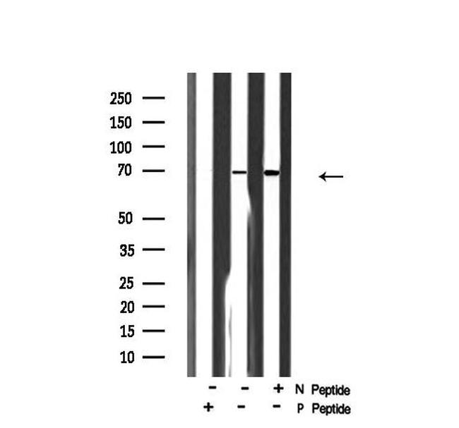 Phospho-KV3.4 (KCNC4) (Ser15) Antibody in Western Blot (WB)