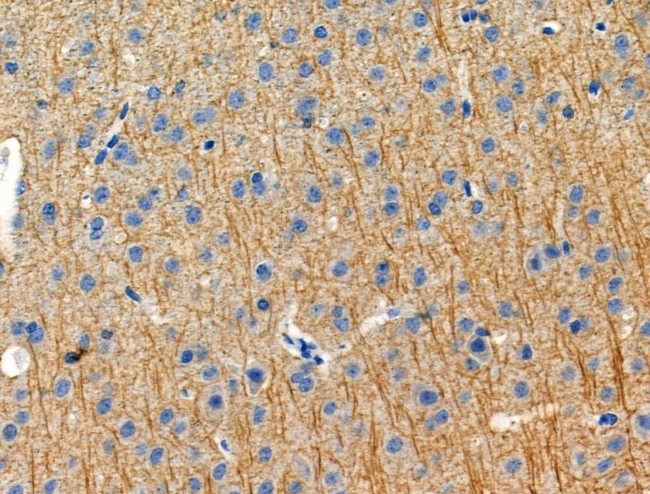 Phospho-KV4.2 (KCND2) (Ser616) Antibody in Immunohistochemistry (Paraffin) (IHC (P))