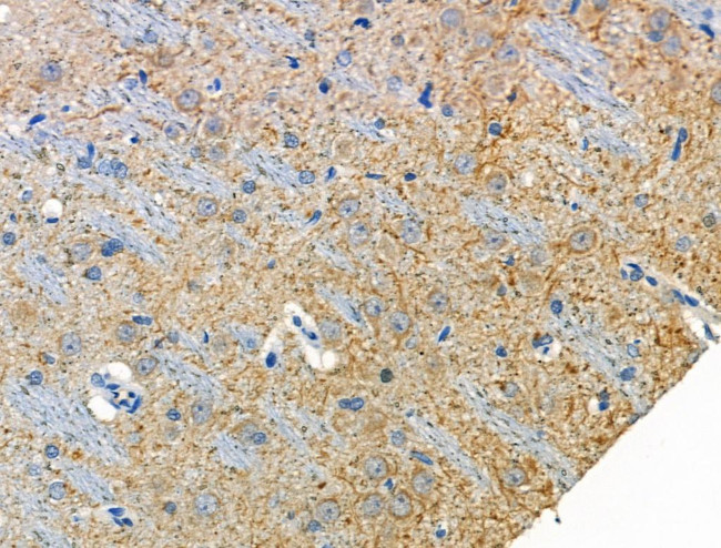 Phospho-KV4.2 (KCND2) (Ser616) Antibody in Immunohistochemistry (Paraffin) (IHC (P))