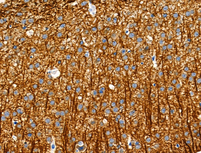 Phospho-MAP4 (Ser696) Antibody in Immunohistochemistry (Paraffin) (IHC (P))