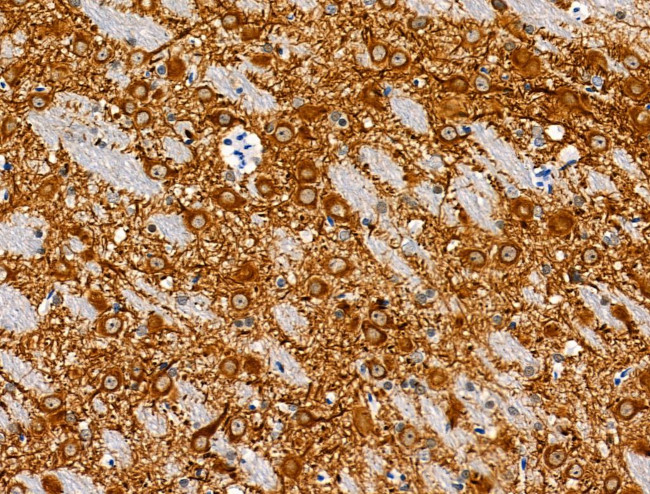 Phospho-MAP4 (Ser696) Antibody in Immunohistochemistry (Paraffin) (IHC (P))