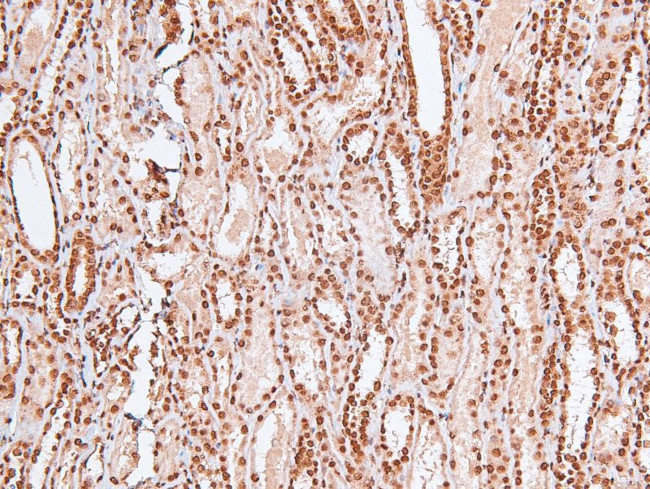 Phospho-MARK Pan (Thr215) Antibody in Immunohistochemistry (Paraffin) (IHC (P))