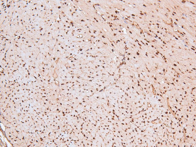 Phospho-MARK Pan (Thr215) Antibody in Immunohistochemistry (Paraffin) (IHC (P))