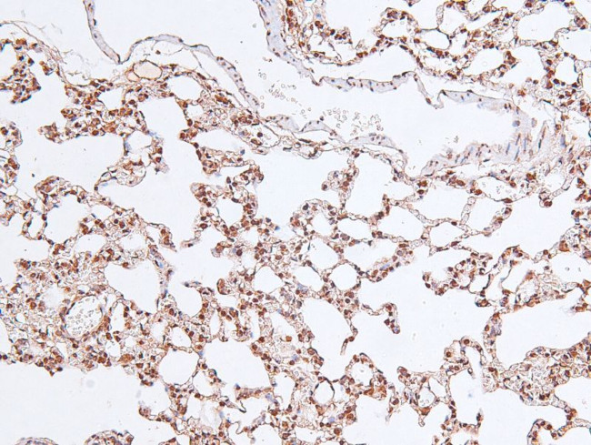 Phospho-MARK Pan (Thr215) Antibody in Immunohistochemistry (Paraffin) (IHC (P))