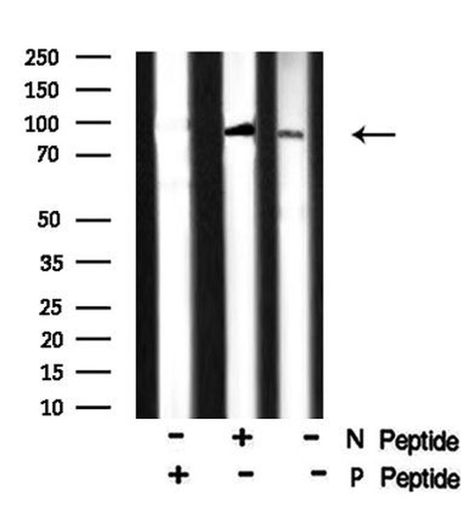 Phospho-MARK Pan (Thr215) Antibody in Western Blot (WB)