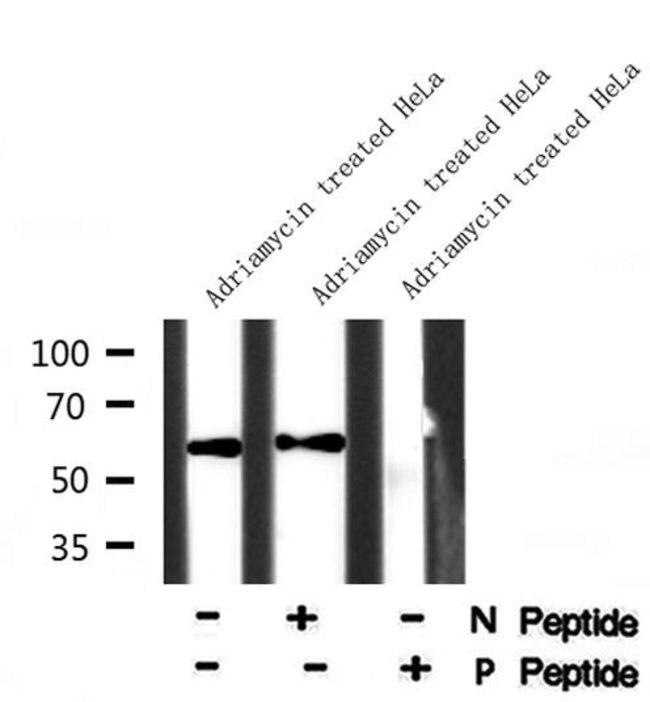 Phospho-TGFBR1 (Ser165) Antibody in Western Blot (WB)