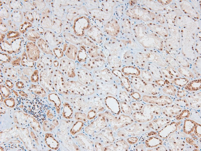 Phospho-TGFBR3 (Thr843) Antibody in Immunohistochemistry (Paraffin) (IHC (P))