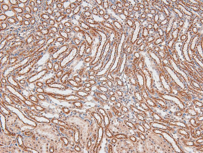 Phospho-TGFBR3 (Thr843) Antibody in Immunohistochemistry (Paraffin) (IHC (P))