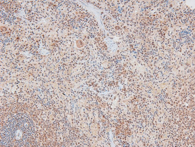 Phospho-TGFBR3 (Thr843) Antibody in Immunohistochemistry (Paraffin) (IHC (P))