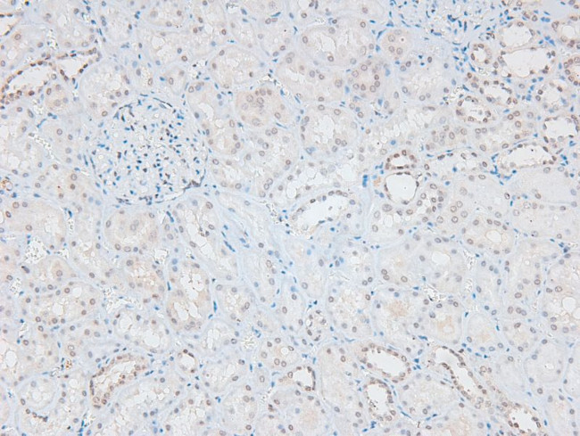 Phospho-Catenin alpha-1 (Ser641) Antibody in Immunohistochemistry (Paraffin) (IHC (P))