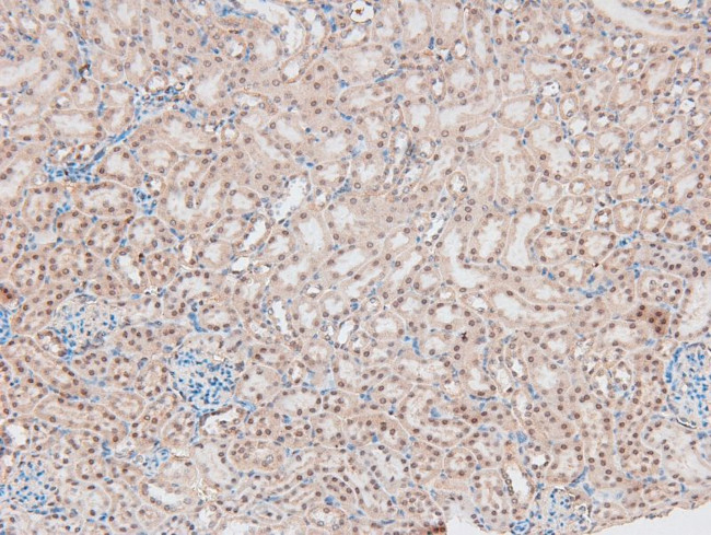 Phospho-Catenin alpha-1 (Ser641) Antibody in Immunohistochemistry (Paraffin) (IHC (P))